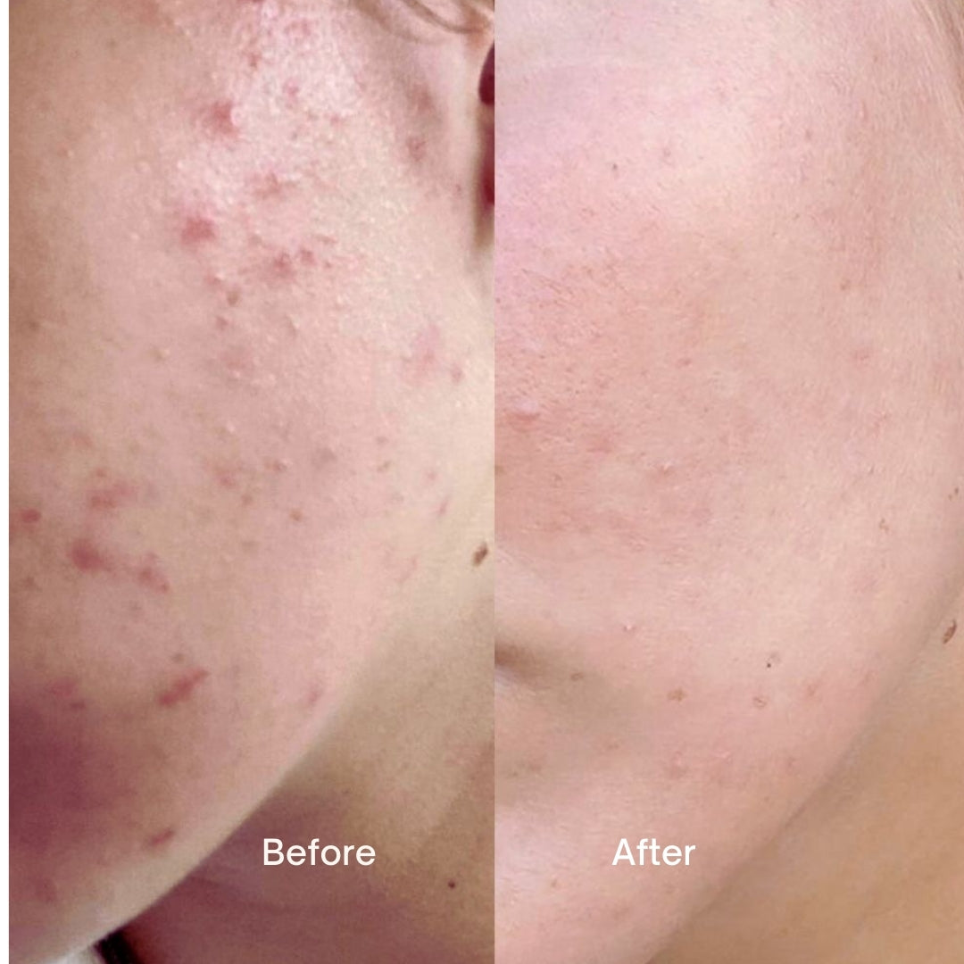 Daily Facial cleanser